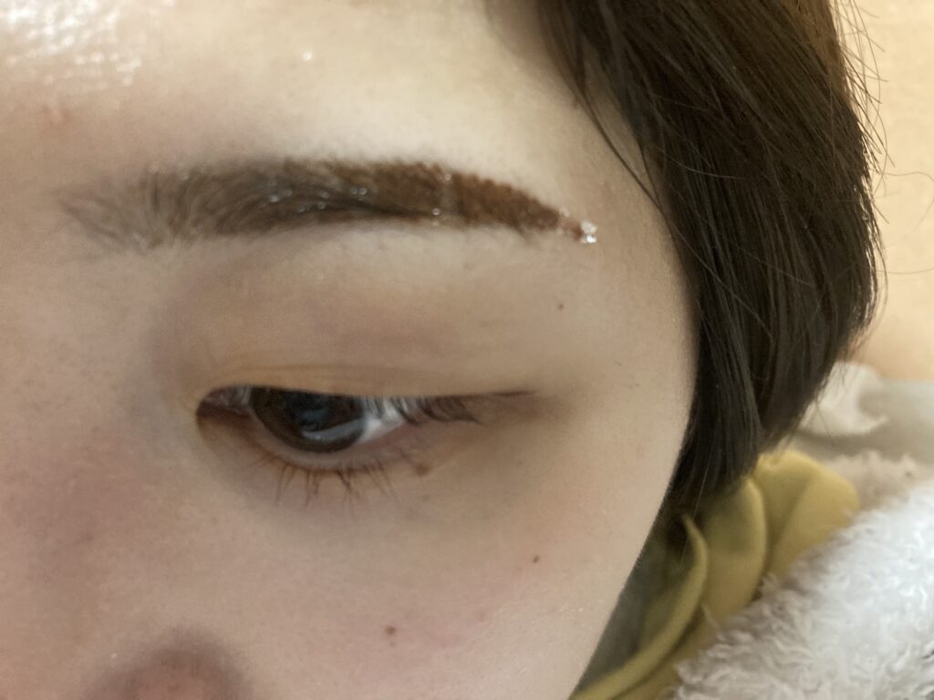 アートメイクダウンタイム中の眉毛の様子