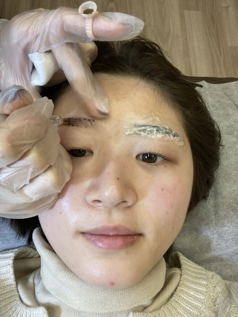 眉毛アートメイク施術の様子