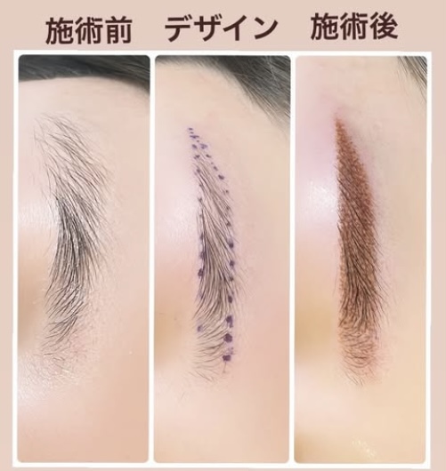 台湾眉毛アート_ビフォーアフター